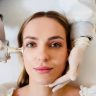 Woman receiving CO2 CoolPeel laser resurfacing treatment at Yeppeun Skin Clinic in Jumeirah 2, Dubai