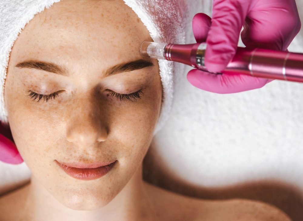 CO2 laser mole and skin tag removal treatment at Yeppeun Skin Clinic, a DHA-licensed aesthetic clinic in Jumeirah 2, Dubai