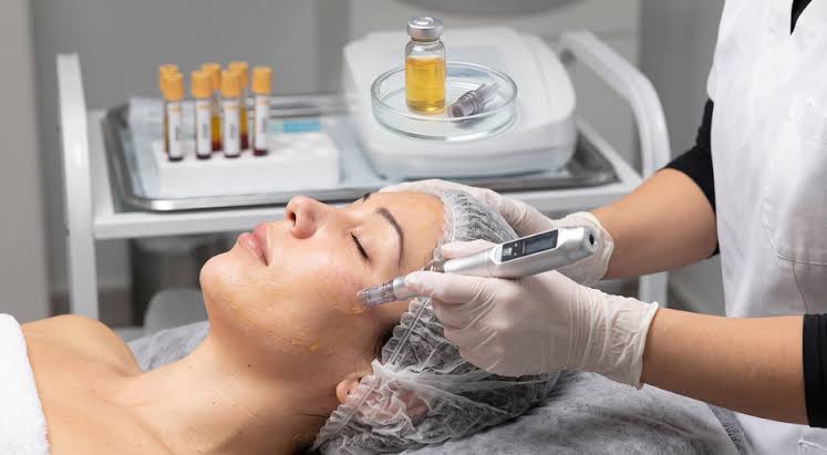 PRP Facial Dubai: