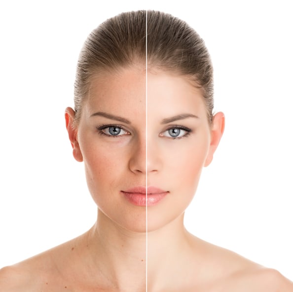 Split-face comparison showing before and after skin rejuvenation treatment on a woman's face for clinic services