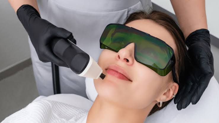 V-Laser at Yeppeun Skin Clinic Dubai