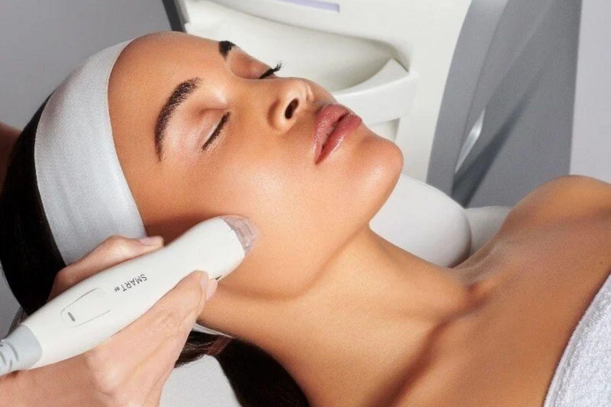 RF microneedling treatment using Virtue Divine Smart Mode device at Yeppeun Skin Clinic, Jumeirah 2, Dubai