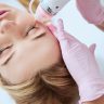 Korean-standard VirtueRF RF microneedling treatment being performed on the face at Yeppeun Skin Clinic, Jumeirah 2, Dubai.