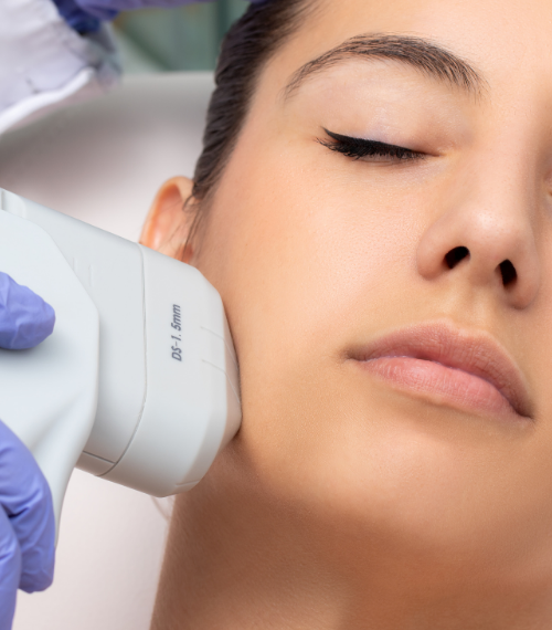 Woman undergoing Ultherapy ultrasound treatment on lower cheek and jawline, handheld device applied by gloved clinician