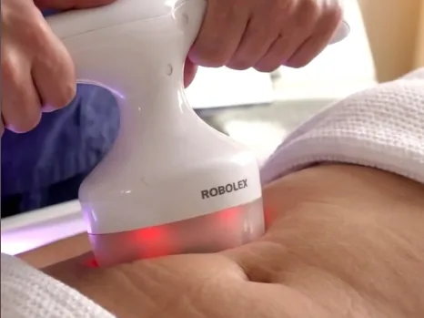 Treatments - Body Contouring Card at Yeppeun Skin Clinic Dubai