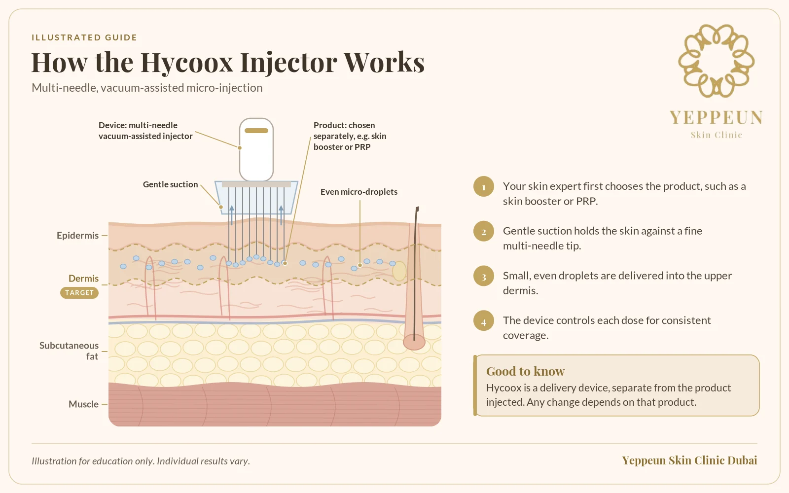 Multi-needle injector illustration of micro-droplets placed in the upper dermis - Yeppeun Skin Clinic Dubai