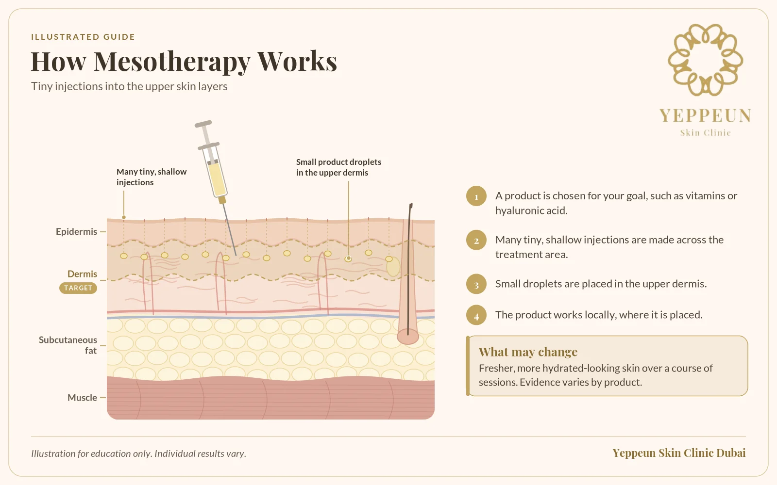 Micro-injection illustration of small product droplets in the upper dermis - Yeppeun Skin Clinic Dubai
